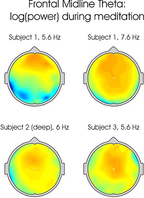 Clinical Applications of Meditation